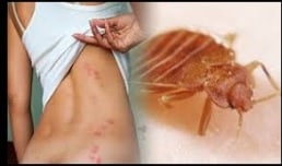 מדביר פשפשים